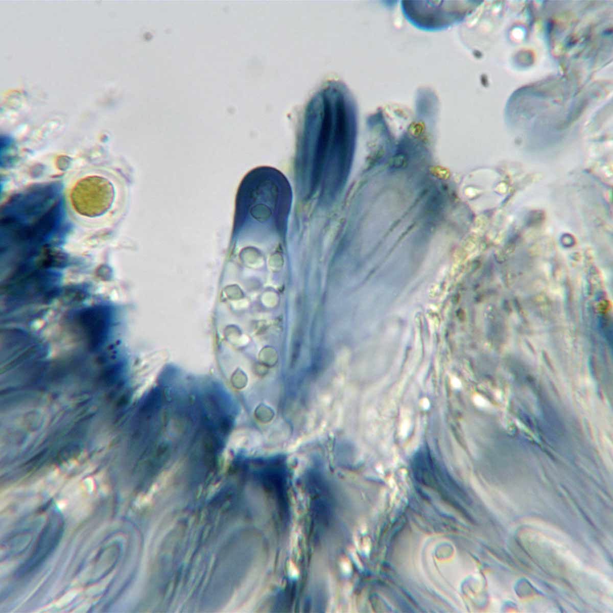 Now I have flushed with acetic acid and then added dilute Lugol's iodine solution. The starchy (amyloid) parts of the ascus tip have stained blue.