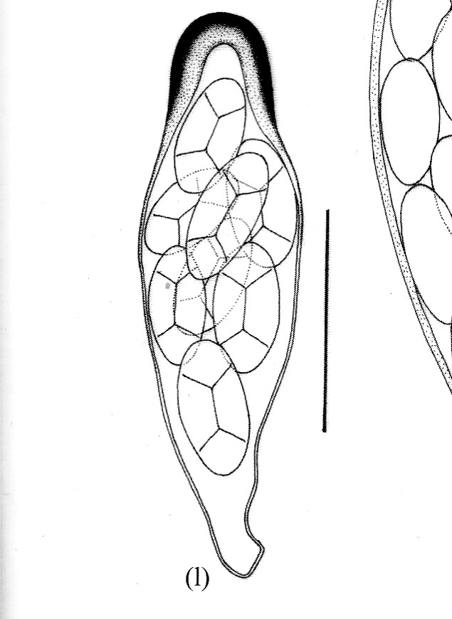 The Teloschistes-type ascus as illustrated in LGBI2 and my attempt. Never as clear as it appears in drawn illustrations but basically showing the same structure.