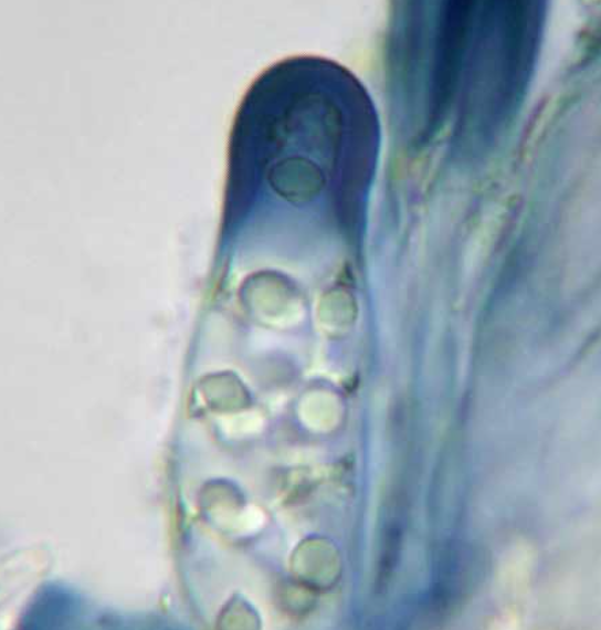 The nature of the ascus tip is often important in arriving at the correct genus but it is a technique which many shy away from. It requires observation at high power and much patience.