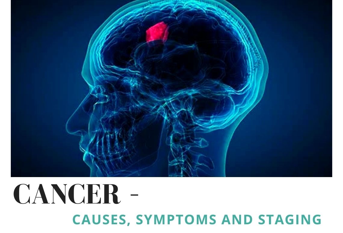The earlier , the better! Read the full blog to know more about the causes, symptoms and staging of cancer. 
cancercentrecalcutta.org/cancer-causes-…
#sgccricare #blogpost #websiteblog #cancer #preventionisbetterthanthecure #affordabletreatment #ourvision #mission #thakurpukur #bestinfrastructure