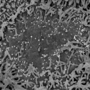 La perte d’odorat chez les patients aux différents stades du  #COVID19 enfin élucidée cnrs.fr/fr/covid-19-de… le SARS-CoV-2 infecte les neurones sensoriels et provoque une inflammation de l’épithélium et du système nerveux olfactif <a href="/CNRS/">CNRS 🌍</a> @INSB_CNRS <a href="/Inserm/">Inserm</a> <a href="/APHP/">Assistance Publique – Hôpitaux de Paris (AP-HP)</a> <a href="/institutpasteur/">Institut Pasteur, since 1887</a>