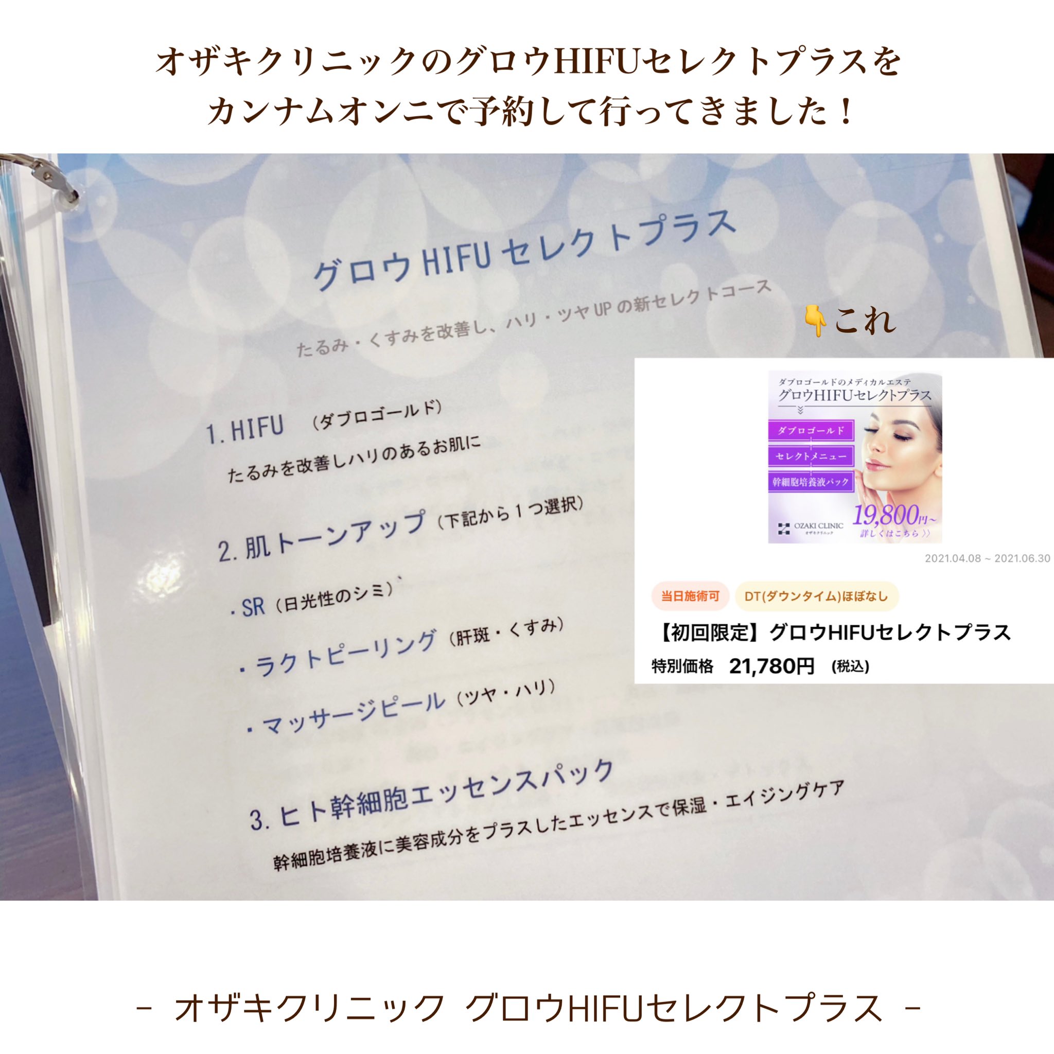 Michika 今日はカンナムオンニのイベント予約した オザキクリニックの グロウhifuセレクトプラス っていうのを受けてきました 肌のたるみとかくすみを改善してくれる施術なんだけど 即効性あって目に見えてトーンアップしてて大満足 この効果は余裕で