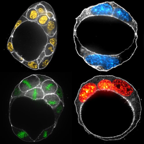Markus Schliffka (@mschliffka) on Twitter photo So happy to see our myosin mutants published in <a href="/eLife/">eLife - the journal</a> after a very constructive review process with <a href="/ReviewCommons/">Review Commons</a>!
elifesciences.org/articles/68536 So happy to see our myosin mutants published in <a href="/eLife/">eLife - the journal</a> after a very constructive review process with <a href="/ReviewCommons/">Review Commons</a>!
elifesciences.org/articles/68536