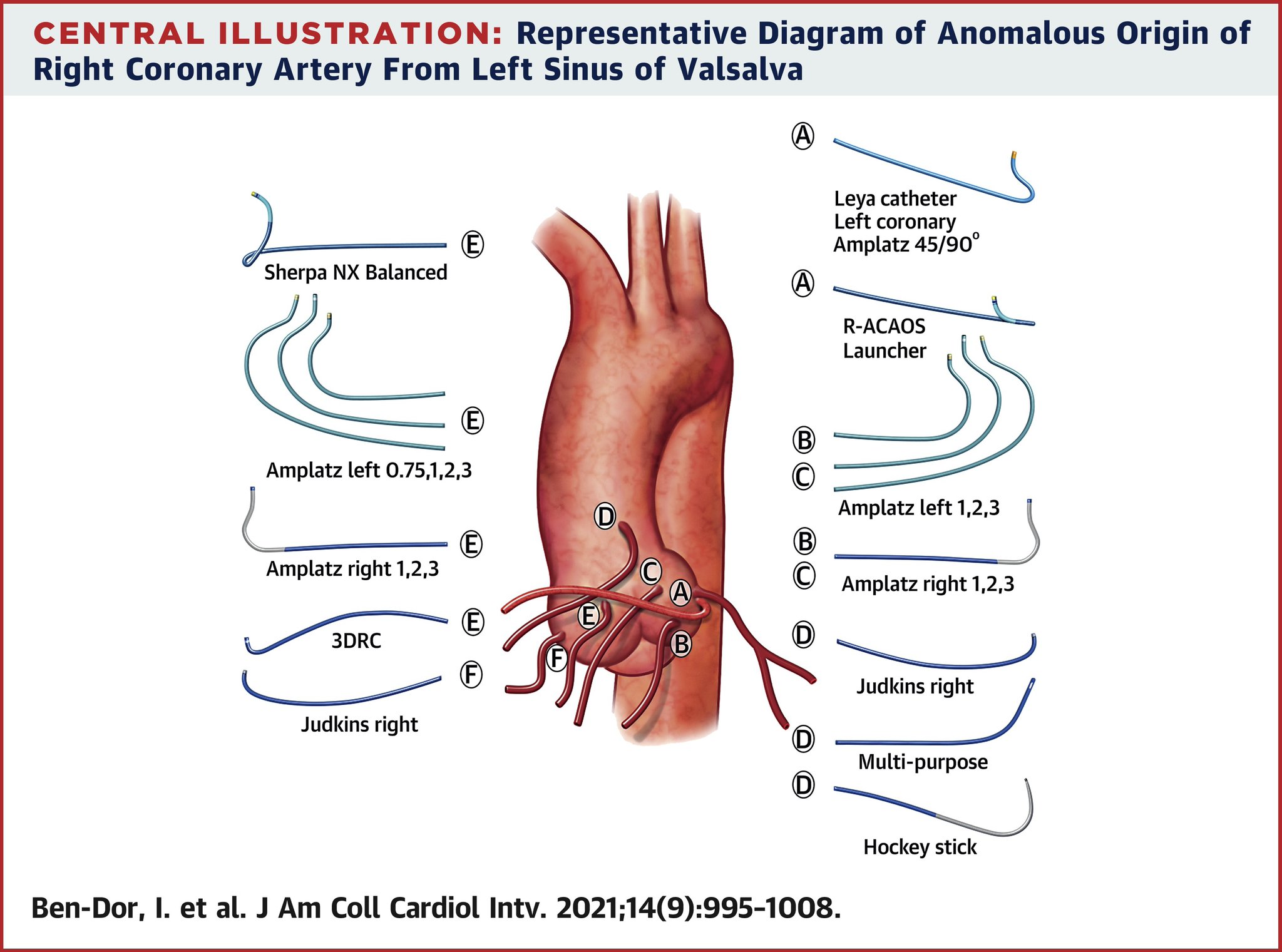 JACC Journals On Twitter Where Is The Coronary Artery This State of jacc-journals-on-twitter-where-is-the-coronary-artery-this-state-of