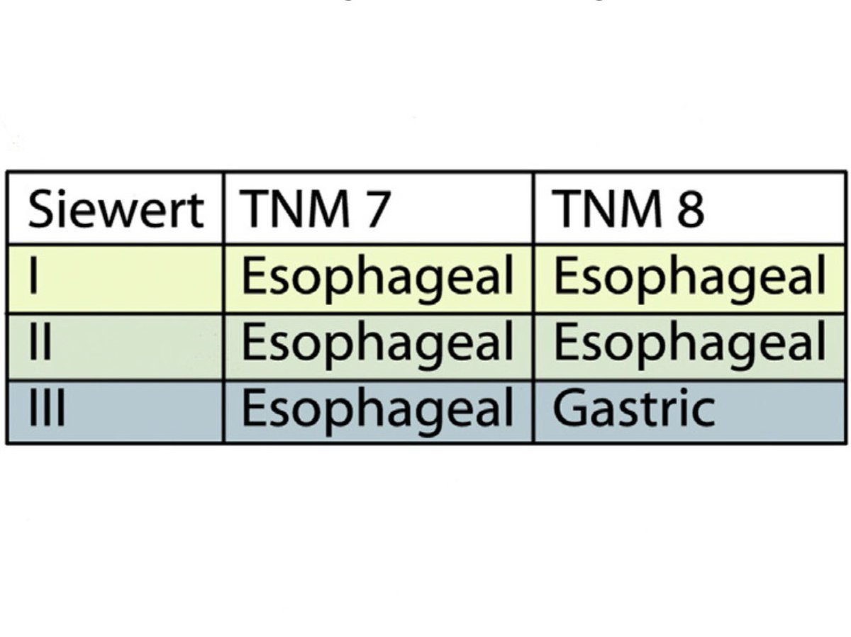 Siewert classification of GOJ tumours 💡 #MedEd #GITwitter