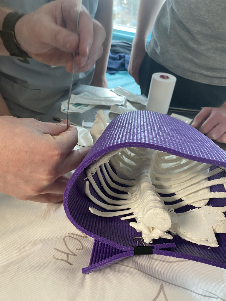 Charles Larson (@charlesplarson) on Twitter photo Using #3DPrinted task trainers to enhance realism in a skills and #medicalsimulation day for ICU, ED and transport teams. Had a great time, broke a few ribs and learned valuable lessons with Andrew Dixon and <a href="/Gomander/">Geoff Brin</a> Using #3DPrinted task trainers to enhance realism in a skills and #medicalsimulation day for ICU, ED and transport teams. Had a great time, broke a few ribs and learned valuable lessons with Andrew Dixon and <a href="/Gomander/">Geoff Brin</a>