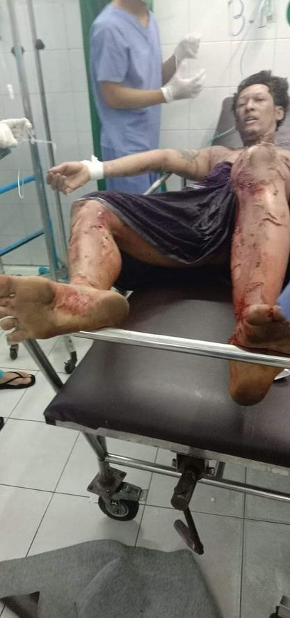 spring21MM's tweet photo. Around 3 am this morning, Ko Phoe Thaw was abducted by the military terrorists in #NorthOkkalapa Hospital while he was undergoing surgery due to bomb blast injuries last night, according to a source close to him.
#May6Coup
#WhatsHappeningInMyanmar https://t.co/VifgR6VrbD