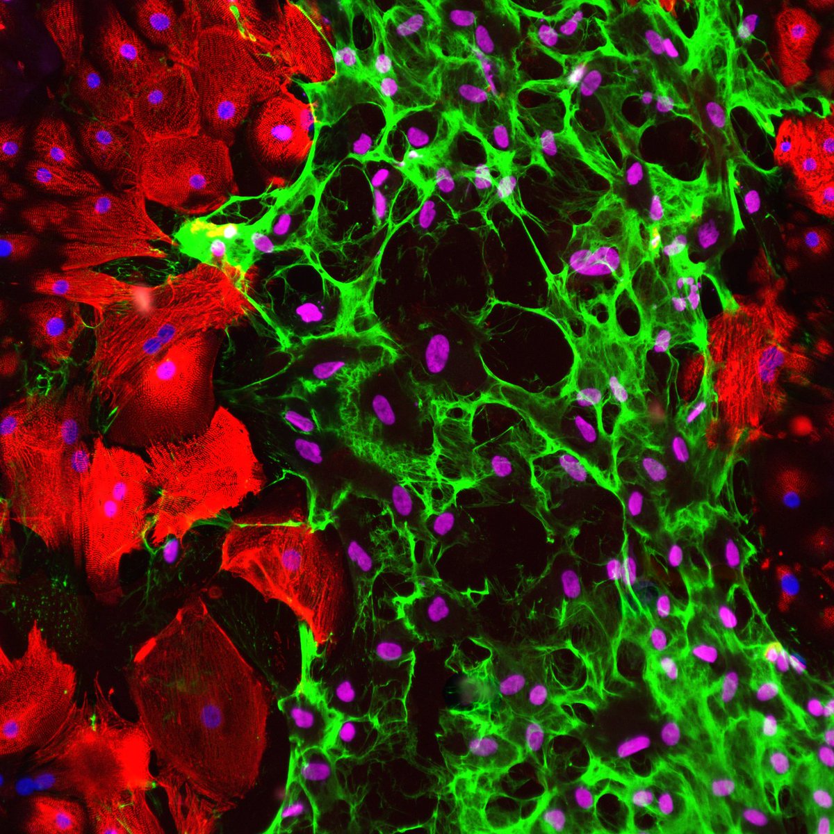 Ignore all the other beautiful photos and vote for my stem cell scar tissue! #StemCellfie #stemcell <a href="/SmithLabUEA/">Smith Lab UEA</a> <a href="/troeberg/">Troeberg lab</a>

stemcell.com/stemcellfie