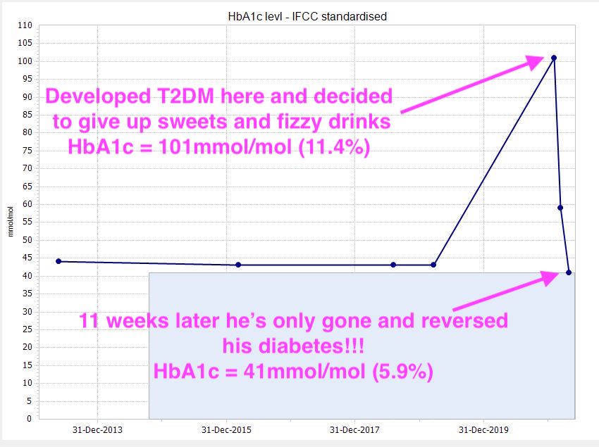 2/7 Bill burst into tearswhen I told him he had reversed his type 2 diabetesHe had worried about another stroke, wanted to his risk + even reverse his T2DM if possibleIt was!Supported by his wife, he reversed his diabetes in only 11 weeks by cutting out sugar  #LCHF 
