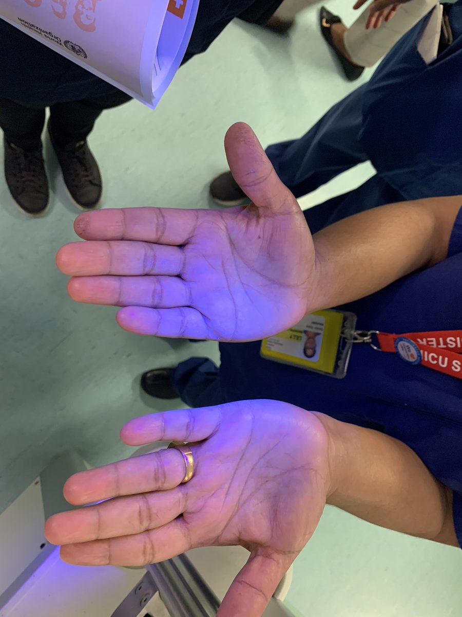 Our NICU &amp; SCBU nurses showing off their clean hands following good #HandHygiene #CleanYourHands 🙌🏼