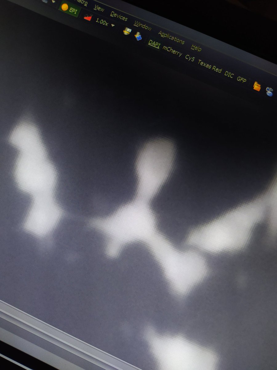 That odd bivalent #plantmeiosis #meiosis #brassica