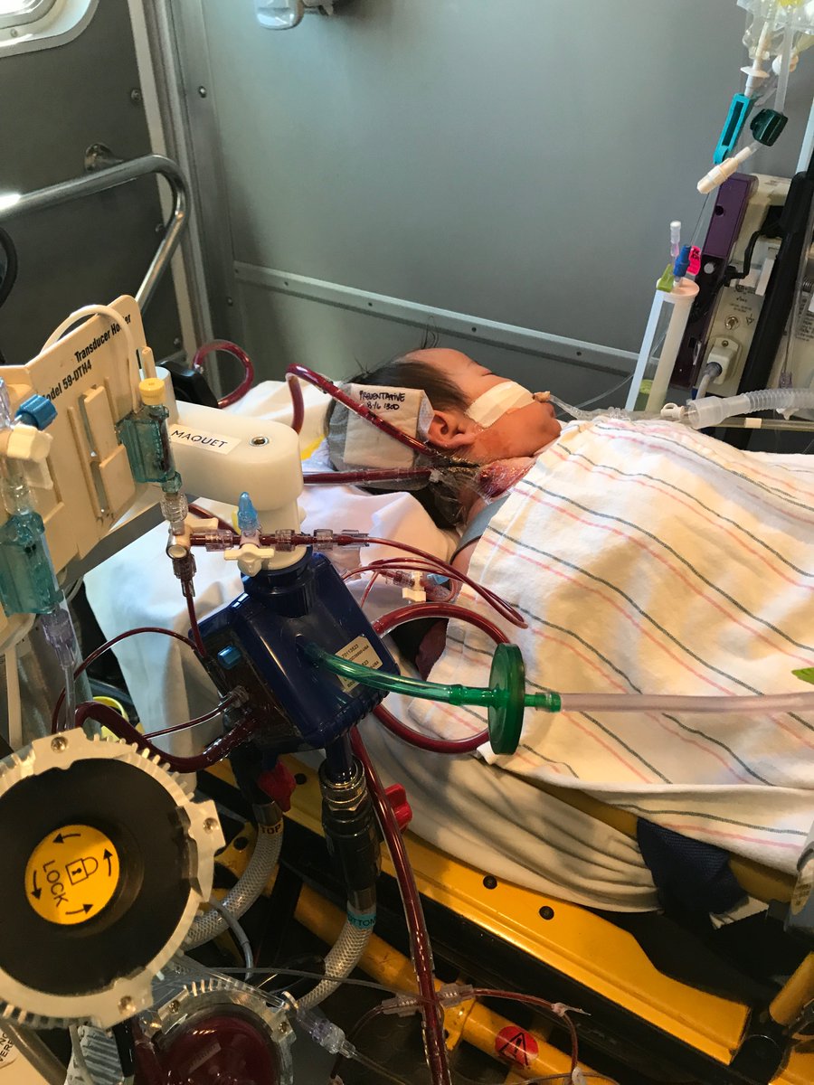 Innovative ECMO Concepts Inc. tweet media