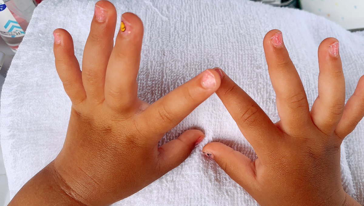 Nailcare 最強ケアリスト Nailcarec Twitter