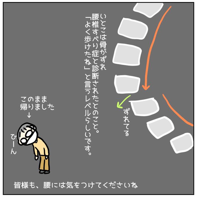 腰椎すべり症のtwitterイラスト検索結果 腰椎すべり症のtwitterイラスト検索結果
