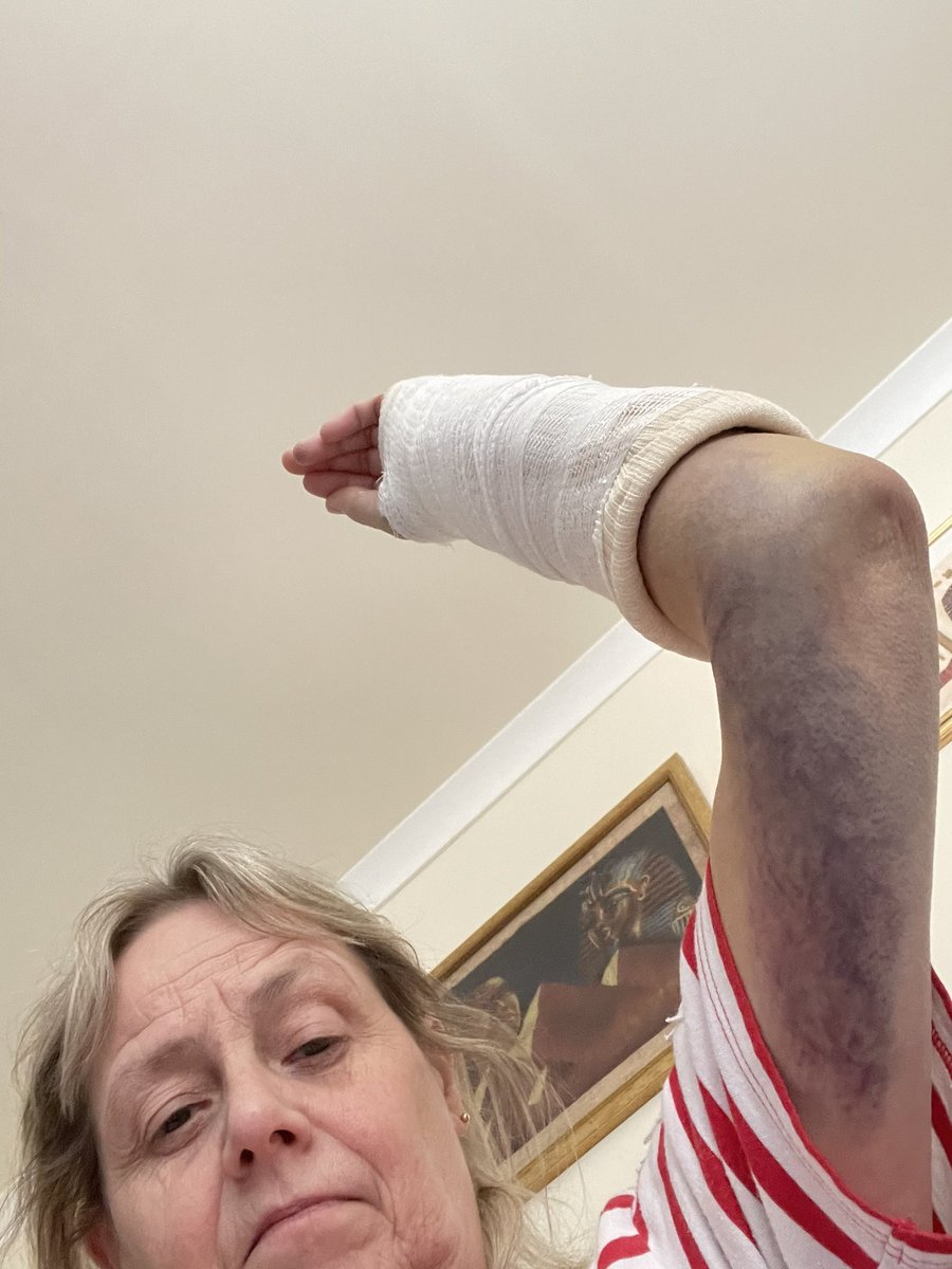 snoopsdf's tweet photo. Ouch https://t.co/b38DvSHLvn