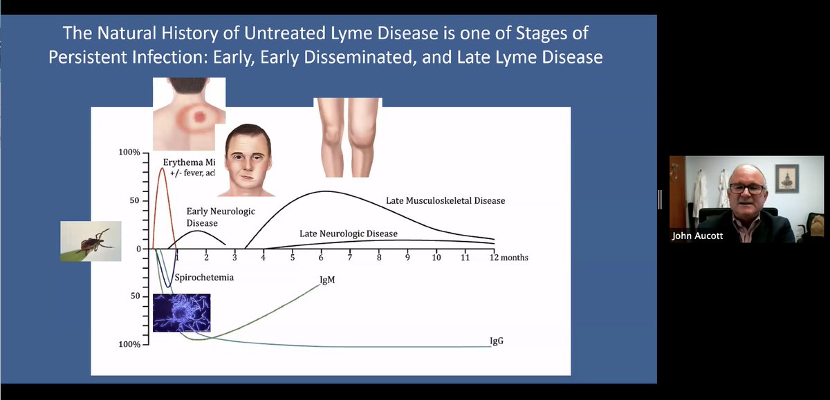 30% of people with  #LymeDisease reported to the CDC have Lyme arthritis, meaning they were not treated until the infection had diseminated 4-6 months post infection. Persistent Infection = Persistent Lyme