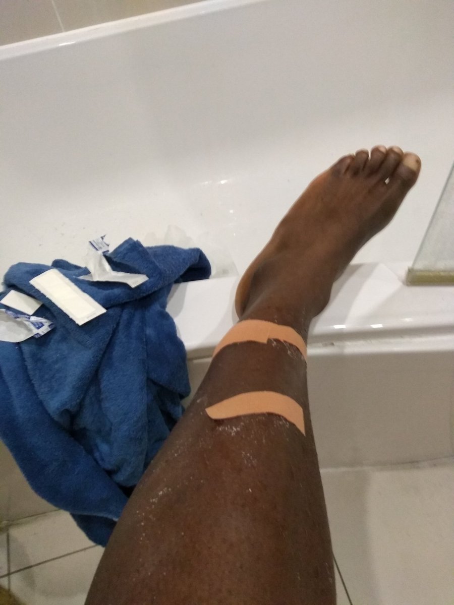 RonnieMushiso's tweet image. Gave it everything. Local #byelections London #AssemblyElections2021 #HartlepoolByElection and then at 9:59pm almost broke my leg running to finally cast my vote! I got really lucky. Good luck to all #Conservativecandidates