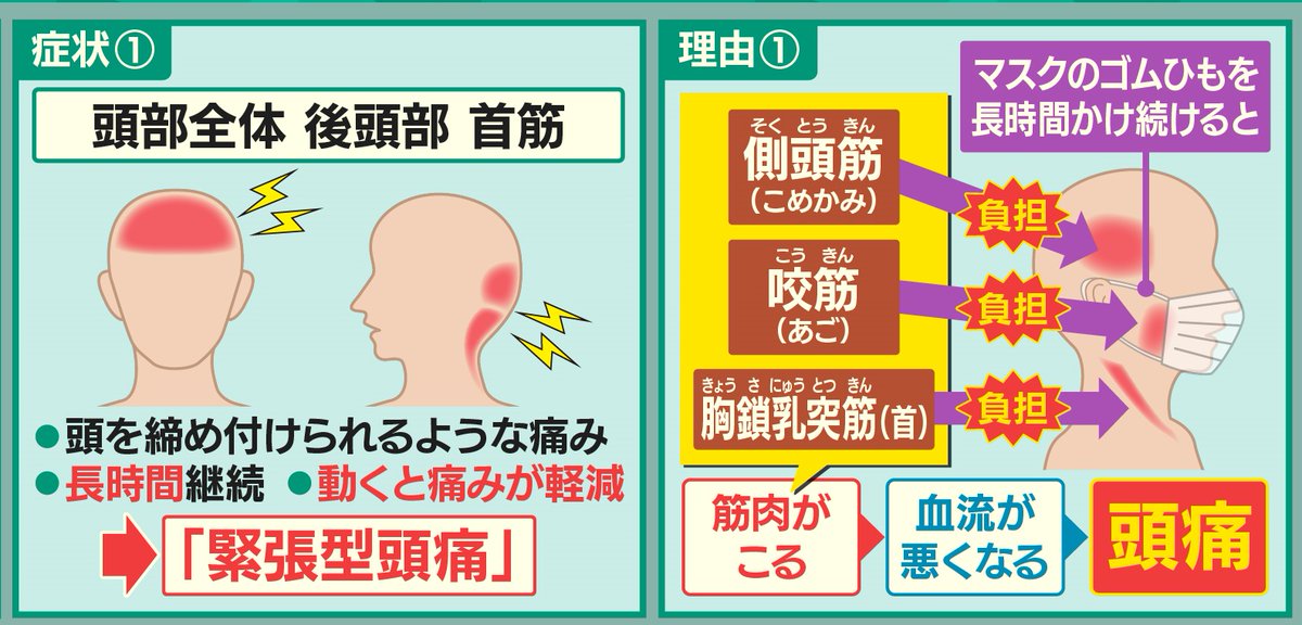 羽鳥慎一モーニングショー 昨日5 6放送 コロナで急増 マスク頭痛 対処法 マスク頭痛 に悩む人が増えています マスク頭痛 には２つの症状があります 症状 は 頭を締め付けられるような痛み 症状 は ズキズキと脈を打つような痛み