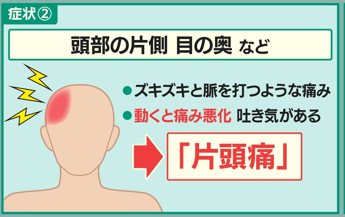 羽鳥慎一モーニングショー 片頭痛 の対処法です １ 人のいない場所でマスクを外し３回ほど深呼吸 ２ 浴室に一晩つるす等で不織布マスクを湿らせる ３ 珈琲 紅茶に少量のブドウ糖を入れて飲む または ブドウ糖を含んだ飴を舐める