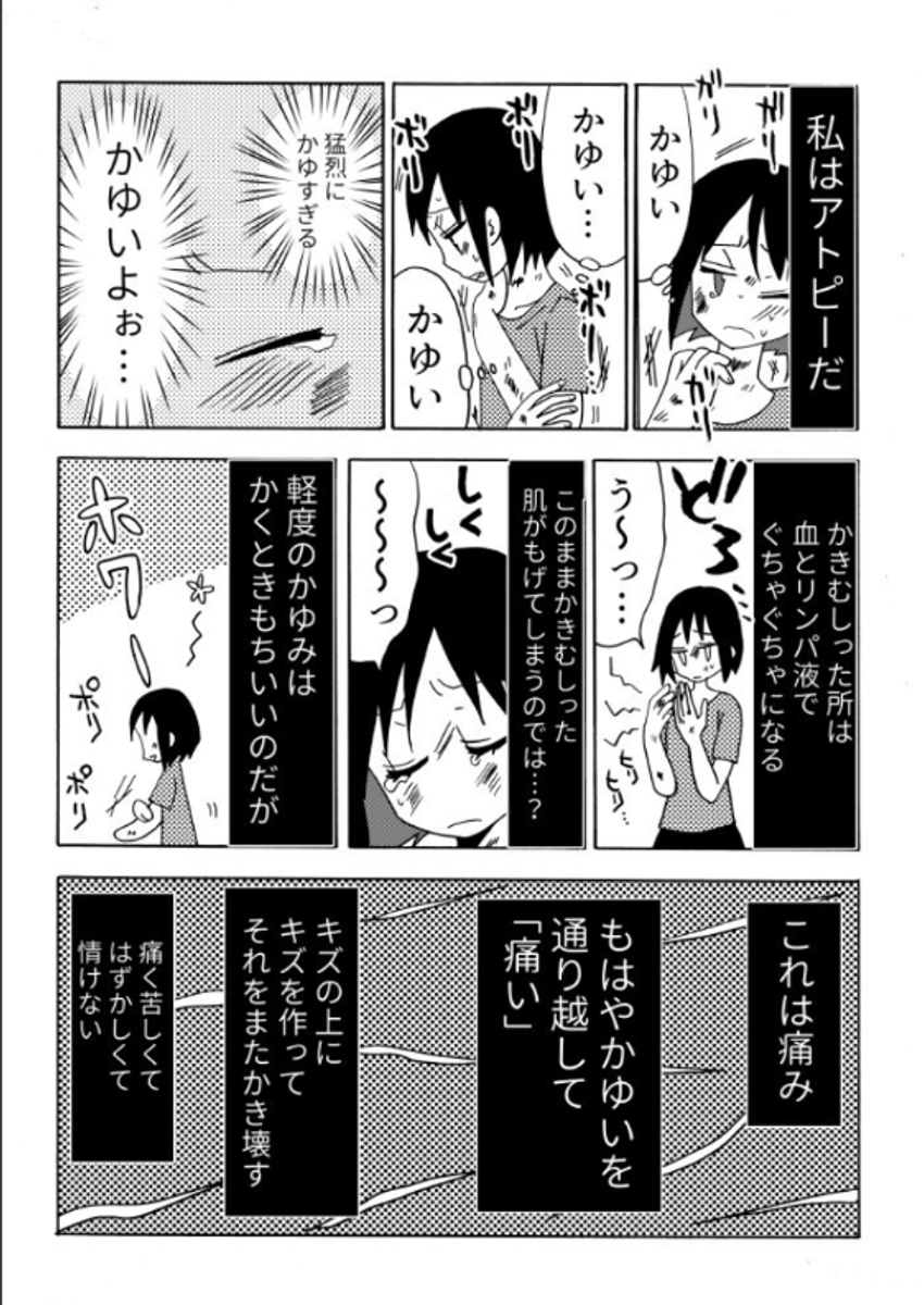 Twoucan アトピー性皮膚炎 の注目ツイート イラスト マンガ コスプレ モデル