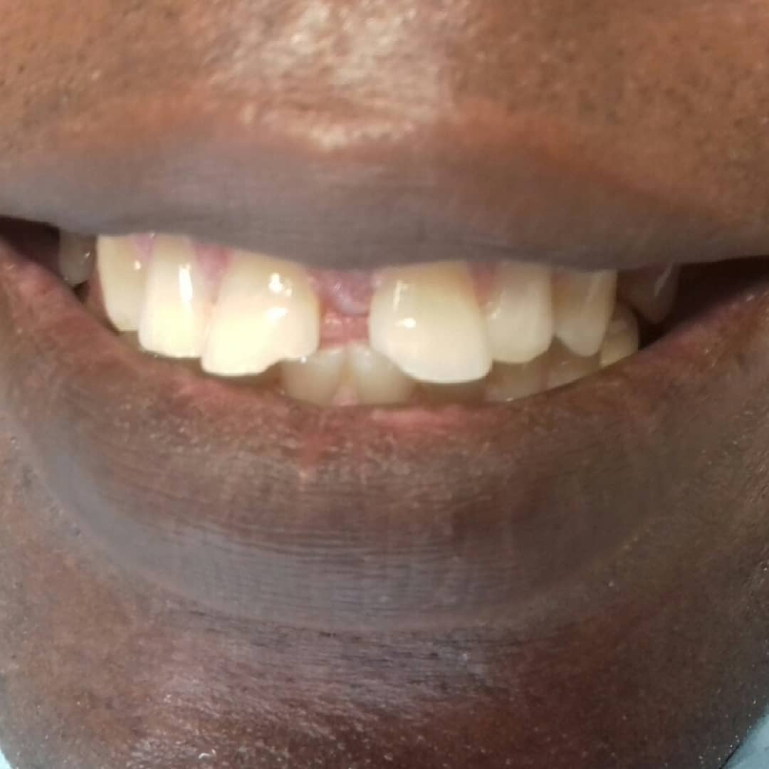ClinicXtan's tweet image. You could be any age and we would still be available to #fixyourteeth. Just like it's not   too late to #FixingTheCountryGhana.