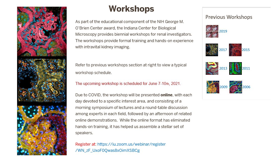 AshkarLab's tweet photo. The Indiana O’Brien Center is excited to present its biennial MICROSCOPY WORKSHOP
June 7-10, 2021--and the best news: it's FREE!!!! ❤️👌
https://t.co/gQXqn2NSm4
Please share! @IUMedSchool @IUKidney @KPMProject #imaging #3DCytometry #Microscopy https://t.co/wK2TYUMxbY