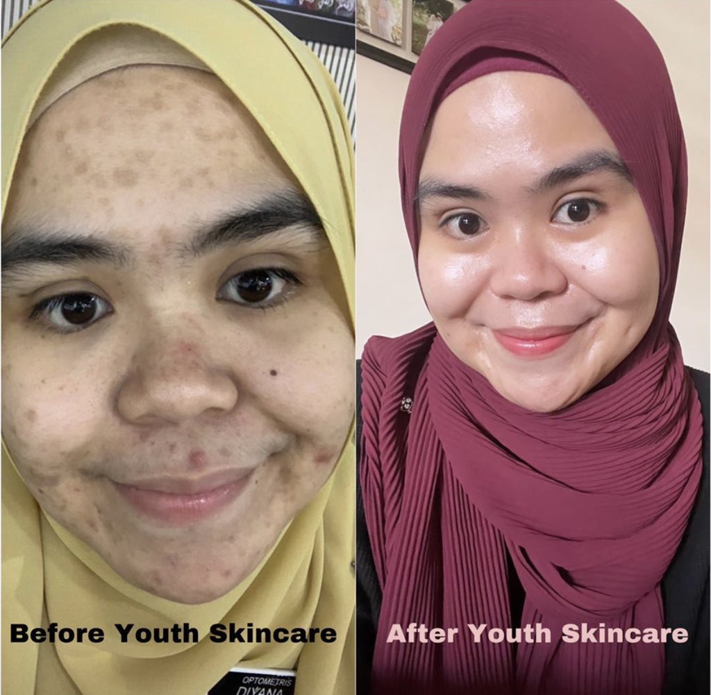 Effect of Youth!😍😍😍 Grab yours now!  wasap.my/60193794776/na…