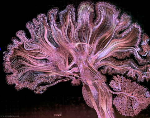 DecipherAnalyt2's tweet photo. Researchers have designed an experimental drug that reversed key symptoms of Alzheimer's disease in mice

https://t.co/fcubiBk0EC

The drug works by reinvigorating a cellular cleaning mechanism that gets rid of unwanted proteins by digesting &amp; recycling them
#DementiaActionWeek https://t.co/VyNWeFAoRV