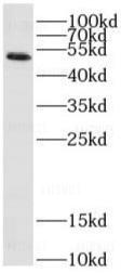 abeomics's tweet photo. SARS-CoV-2 Nucleocapsid Antibody (Clone: 3C6)

For more details visit our website - : https://t.co/bFpHF8acvs and follow the web-page : https://t.co/cQqXAuCRH6

#Monoclonal https://t.co/dC9fh0AtZF