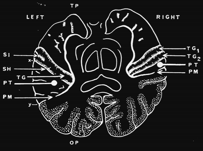 In reference to the coming #schizophreniaawarenessday on 24 May, we are already talking about the hearing of voices. Especially since schizophrenia is one of the core areas of ki:elements.

Find out more here ki-elements.de/2021/05/20/hea…