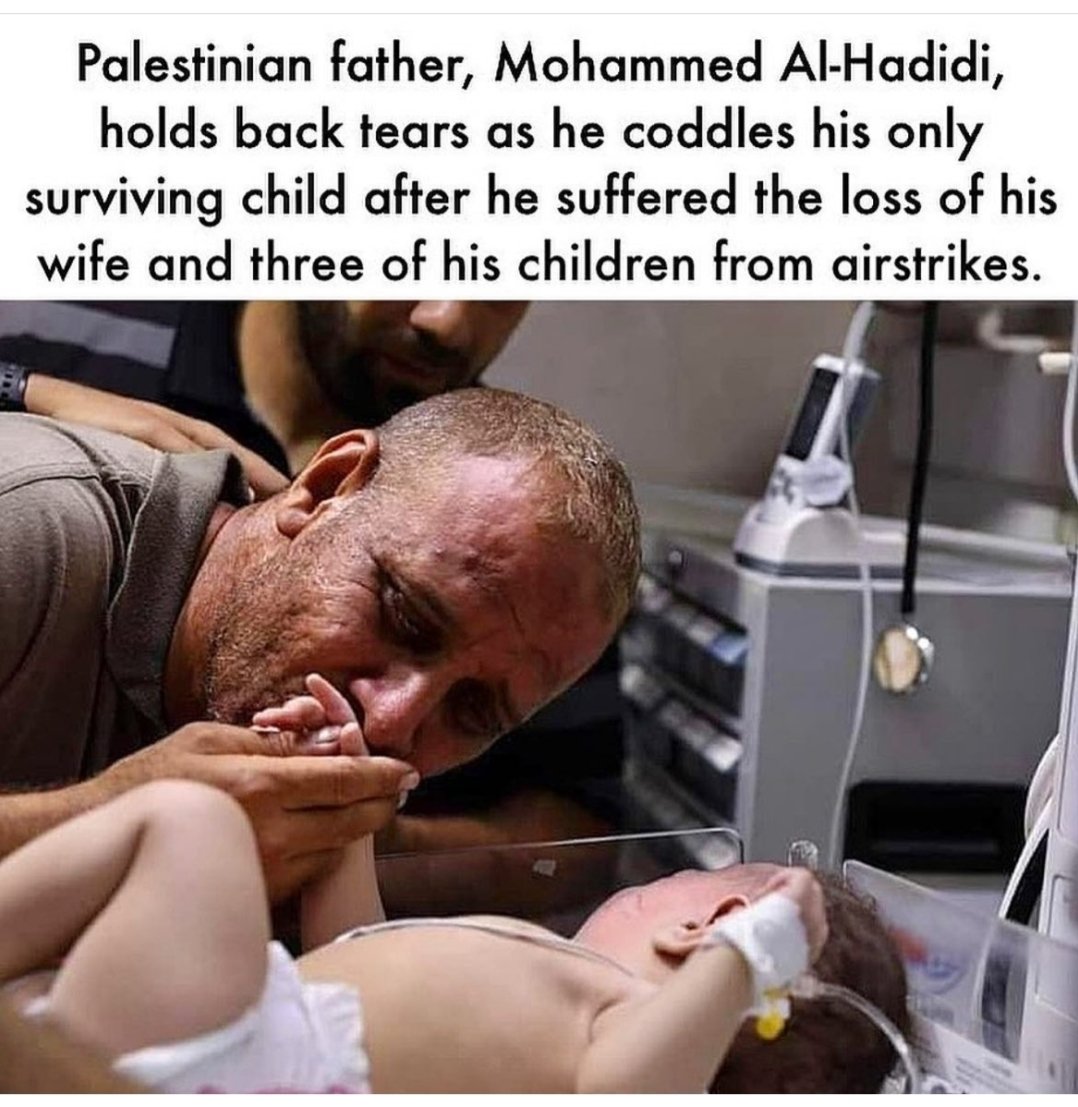 ShaherShaymaa's tweet photo. @CaV1E @Hiro_ZA The Gaza problem is not just inequality and persecution The real problem lies in killing them and wiping them out all, every night of 10 days they are randomly bombed in their homes, so they sit in their homes waiting for death. Look, for example, at this suffering https://t.co/vpbrIc9ZDN