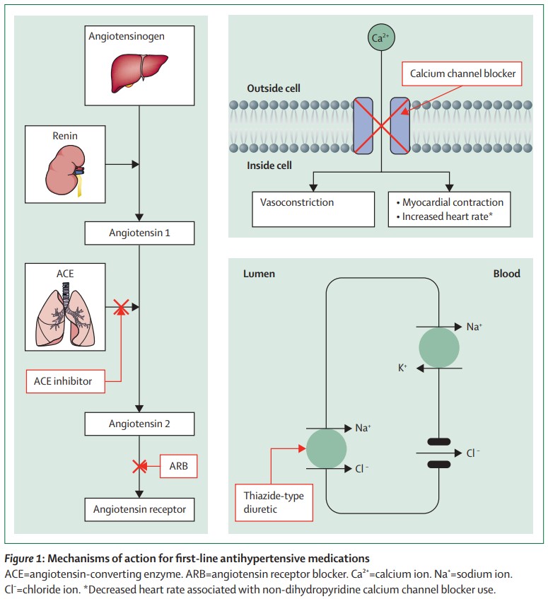Arterial hypertension is the most important contributor to the global burden of disease—yet disease control is poor. A new Seminar from Sofie Brouwers et al. provides an overview of arterial hypertension, treatment options, and future directions. Read hubs.li/H0NL3lk0.