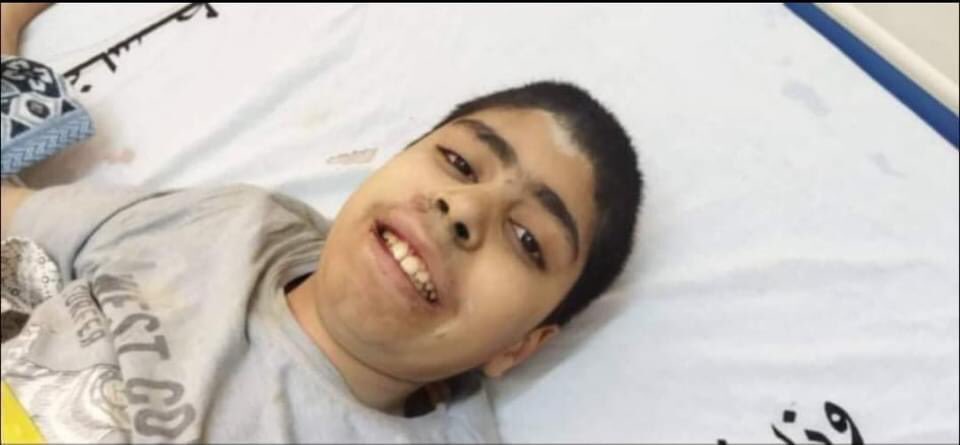 jarad_jaber's tweet photo. هذا هو الطفل عزيز الكولك (10 سنوات) الناجي الوحيد من أسرته التي بقيت تحت الأنقاض لست ساعات متواصلة، وشملت والده ووالدته وطفلين اثنين.
عزيز قال لعمه وهو بالمشفى: "أنا أعلم أنني الناجي الوحيد، لأني رأيت أمي وأبي ينزفون حتى الموت
#هنا_غزة
#GazaUnderAttack 
#savepalestinians https://t.co/FEQicB3aoM