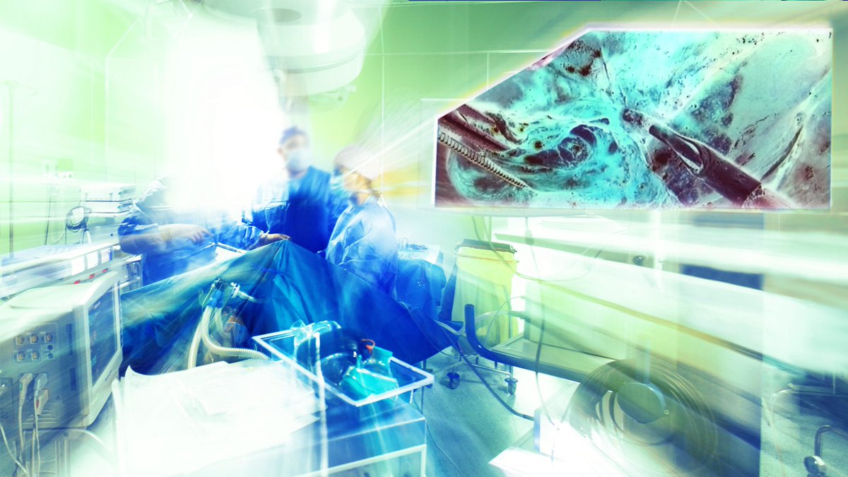 Study suggests Arnica 30c and Bellis 30c reduce seroma after mastectomy. Considering clinical benefits, lack of side effects, low cost and easy implementation of this homeopathic treatment, this is exciting news for women recovering from breast surgery: link.springer.com/article/10.100…