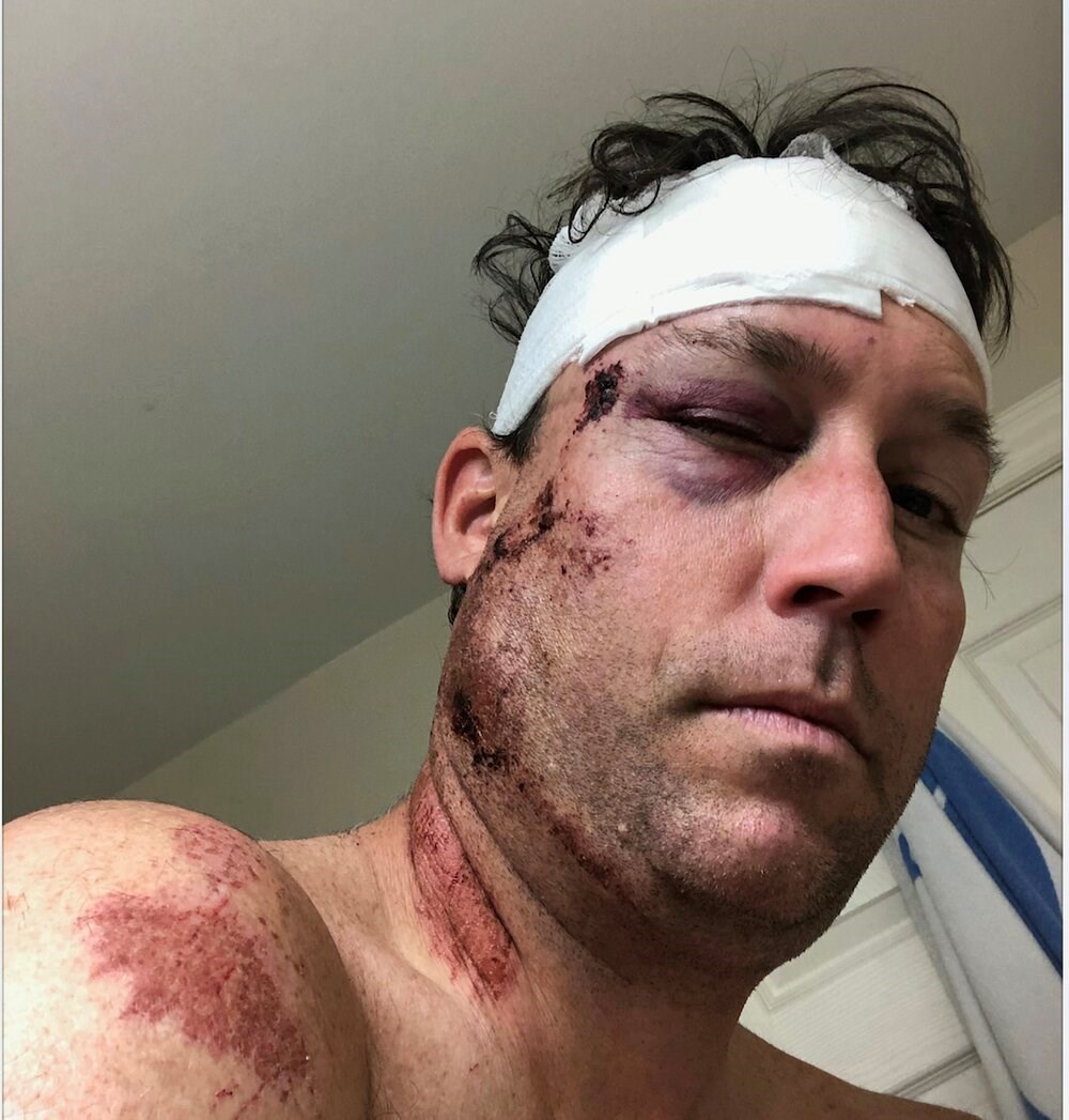 NorthShoreNews's tweet photo. Run over on a sidewalk, North Shore man a test case in new ICBC insurance scheme https://t.co/t50XVy4LRK https://t.co/mSlRSOYG6r