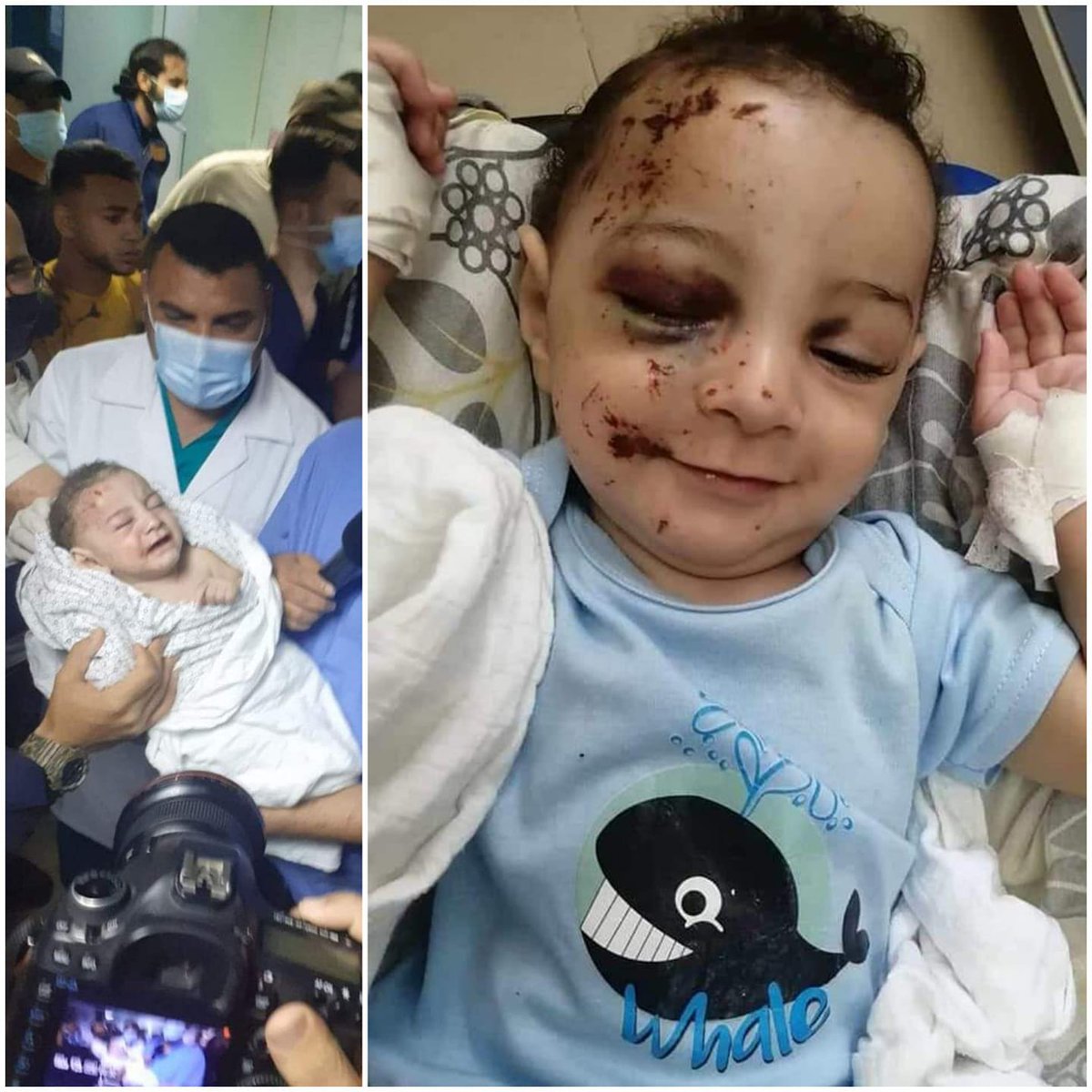 GheedHissy's tweet photo. "Here is Omar! the sole child who survived Beach Camp's massacre few nights ago.
His smile, his resilience is impressive and inspiring, may Allah bless you little angel and heal your wounds at the soonest." Samah Abu Lamzy
#GazaUnderAttackk
#Gaza_Under_Attackk https://t.co/1P3L9Adz5J