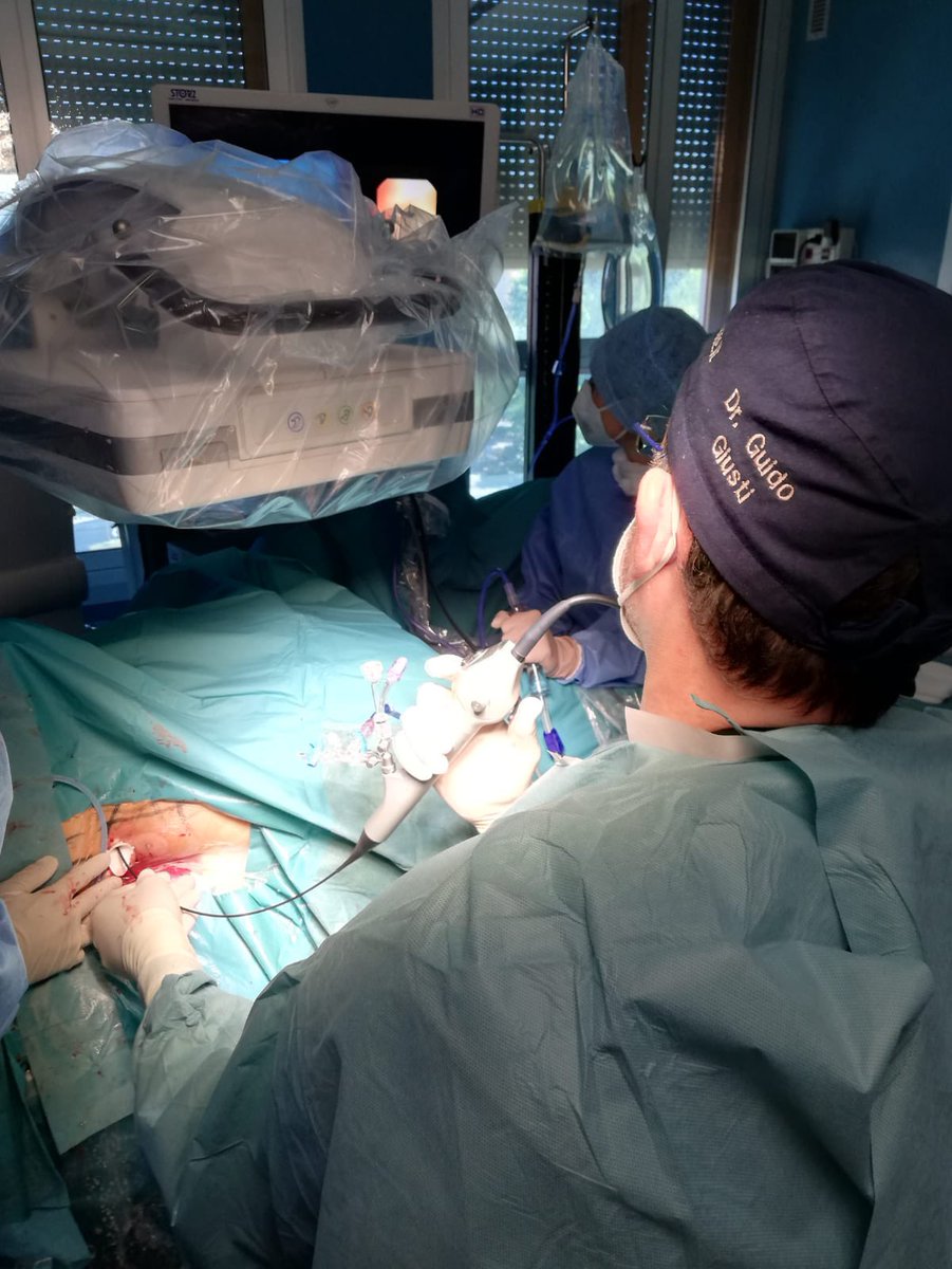 GuidoGiusti's tweet photo. When u deal with ureteric stone in pt with previous pediatric reimplantation consider that it could b a #COHEN 1 where retrograde manipulation is mostly impossible:b ready 2 go antegrade #FURS placing a #UAS as an #amplatz sheath! #supine position eases the choice!#ETCE #teamwork https://t.co/rDh9Jn9NGN
