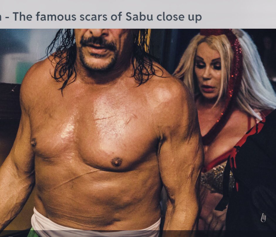 The Super Genie On Twitter Sabu Therealsabuecw Showing Off His Battle Wounds As He And Super Genie Head To The Ring Sabu Ecw Wwe Fmw Prowrestling Hardcore Barbedwire Scars Prowrestler Https T Co S3osxkgm1x