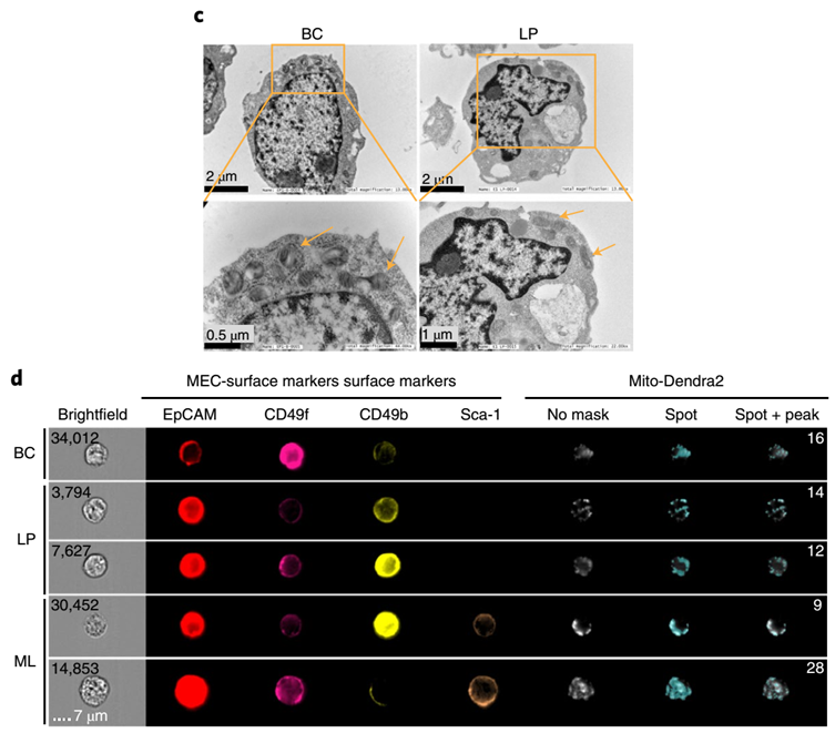 mathepan's tweet photo. We then looked at the form and fxn of the #mitochondria (mito). LP had longer mito with defined cristae (where ETC is housed) and larger mito foci (teal dot = mito). Higher ETC proteins + optimal mito form enabled LP to have enhanced capacity for mito respiration (@ffalohy)/6 https://t.co/jOMlm5ZKqQ