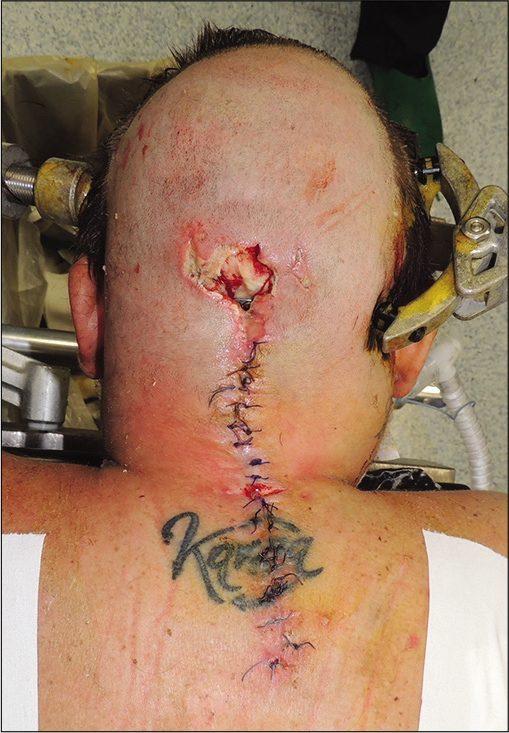 Surgical Neurology International (SNI) tweet media