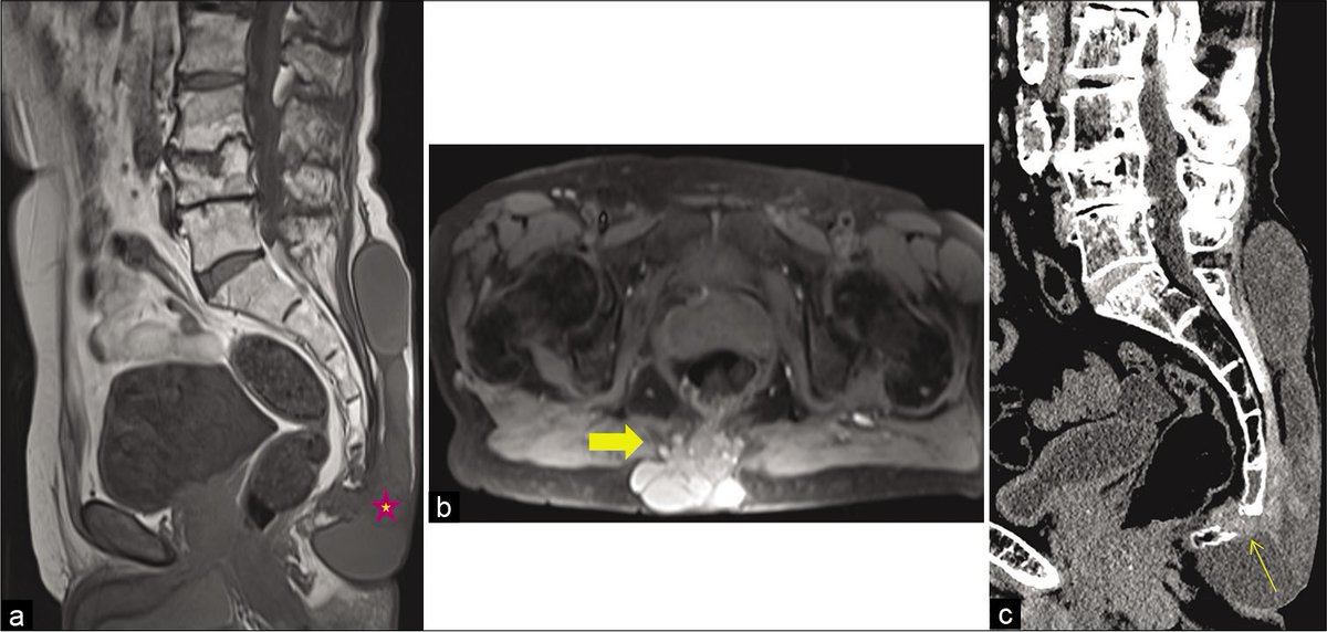 Surgical Neurology International (SNI) tweet media