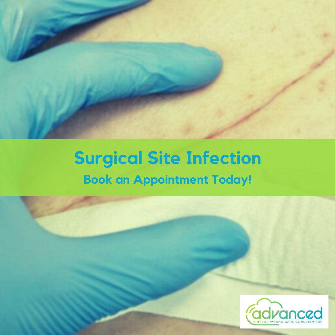 A surgical site incision is susceptible to an infection, especially within the first 30 days. This is where our experts can help assess, prevent, and manage a surgical site infection and avoid any undesired outcome. 

ow.ly/GwSC50EP7Im

#surgicalinfections #woundmanagement