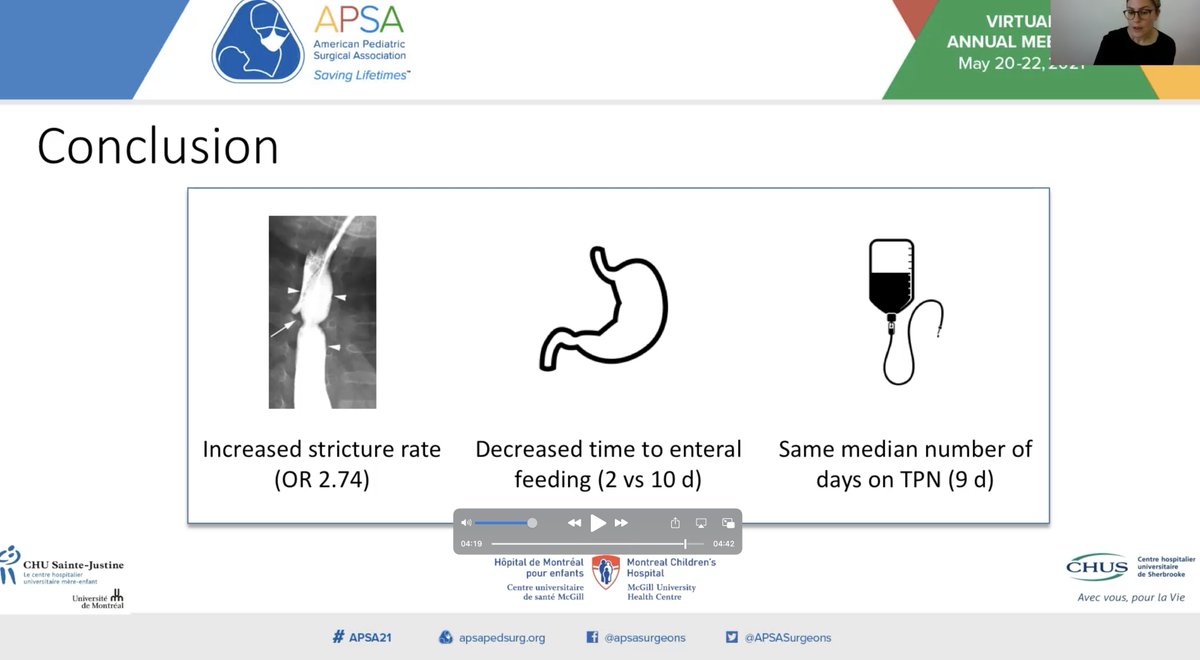 Casey M Calkins (@caseymcalkins) on Twitter photo Yet more evidence that routine use of TA tubes in patients undergoing EA repair should be avoided - great work from our Canadian colleagues in Montreal <a href="/BeardmorePS/">Beardmore Pediatric Surgery | Montreal Children’s</a> <a href="/kathrynlarusso/">Kathryn E. LaRusso</a> <a href="/DrSherifEmil/">Sherif Emil MD,CM</a> ! Awesome presentation at #APSA21 <a href="/APSASurgeons/">APSA Surgeons</a> Yet more evidence that routine use of TA tubes in patients undergoing EA repair should be avoided - great work from our Canadian colleagues in Montreal <a href="/BeardmorePS/">Beardmore Pediatric Surgery | Montreal Children’s</a> <a href="/kathrynlarusso/">Kathryn E. LaRusso</a> <a href="/DrSherifEmil/">Sherif Emil MD,CM</a> ! Awesome presentation at #APSA21 <a href="/APSASurgeons/">APSA Surgeons</a>