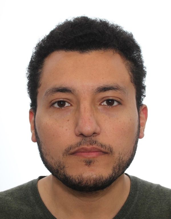 مبتعث سعودي في فرنسا يعيد البصر لمريض

تمكن المبتعث السعودي في فرنسا الدكتور عمرو عبدالعال أبوخشبة، من إجراء جراحة دقيقة لزراعة عدسة جديدة وتثبيتها في جدار العين بطريقة مختلفة تماما عما هو متبع في مثل هذه العمليات.