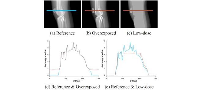 Andreas K. Maier (@maier_ak) on Twitter photo 3D Non-Rigid Alignment of Low-Dose Scans Allows to Correct for Saturation in Lower Extremity Cone-Beam CT
ieeexplore.ieee.org/document/94275âŠ
<a href="/SpirosMargaris/">Spiros Margaris</a> <a href="/antgrasso/">Antonio Grasso</a> <a href="/ResearchGermany/">Research in Germany - Initiative of the BMFTR</a> <a href="/DrJDrooghaag/">Dr. ir Johannes Drooghaag (JD) #BYOC! đ</a> <a href="/BVM_Community/">BVM Community</a> <a href="/unifau/">FAU Erlangen-Nbg</a> <a href="/DGBMT/">DGBMT</a> <a href="/BVMI_eV/">BVMI eV</a> <a href="/gmdsEV/">GMDS e.V.</a> <a href="/medicalvalley/">MedicalValleyEMN</a> <a href="/TF_UNI_Erlangen/">Technische FakultĂ€t (TF) der FAU</a> <a href="/d_h_i_p/">d.hip - digital health innovation platform</a> 3D Non-Rigid Alignment of Low-Dose Scans Allows to Correct for Saturation in Lower Extremity Cone-Beam CT
ieeexplore.ieee.org/document/94275âŠ
<a href="/SpirosMargaris/">Spiros Margaris</a> <a href="/antgrasso/">Antonio Grasso</a> <a href="/ResearchGermany/">Research in Germany - Initiative of the BMFTR</a> <a href="/DrJDrooghaag/">Dr. ir Johannes Drooghaag (JD) #BYOC! đ</a> <a href="/BVM_Community/">BVM Community</a> <a href="/unifau/">FAU Erlangen-Nbg</a> <a href="/DGBMT/">DGBMT</a> <a href="/BVMI_eV/">BVMI eV</a> <a href="/gmdsEV/">GMDS e.V.</a> <a href="/medicalvalley/">MedicalValleyEMN</a> <a href="/TF_UNI_Erlangen/">Technische FakultĂ€t (TF) der FAU</a> <a href="/d_h_i_p/">d.hip - digital health innovation platform</a>