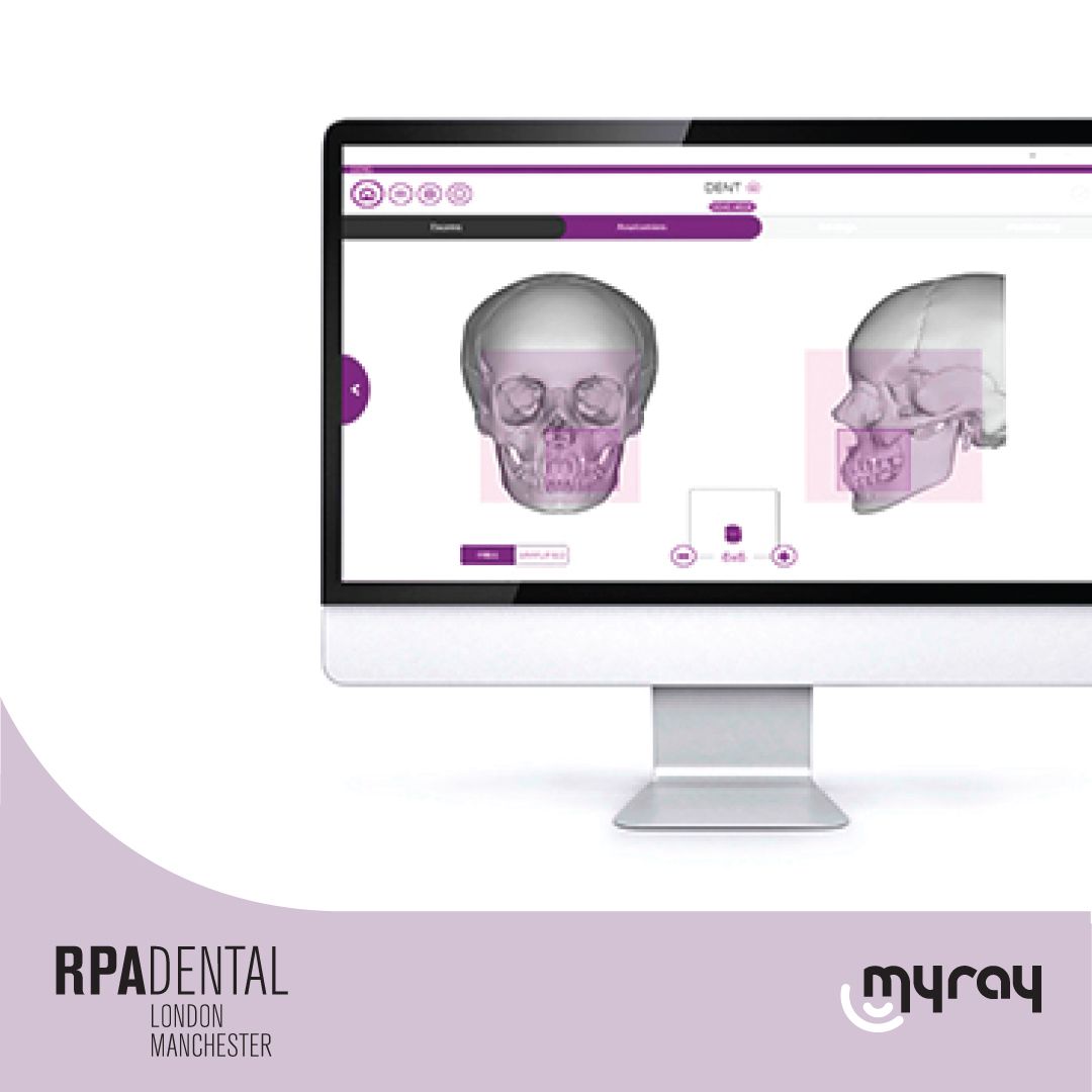 HyperionX9 pro  

PC INTERFACE

The multi-platform control panel gives you easy and immediate access to all the device features. The interface guides you step by step, from the exam selection to its preparation, with FOV guided positioning. #dentistry