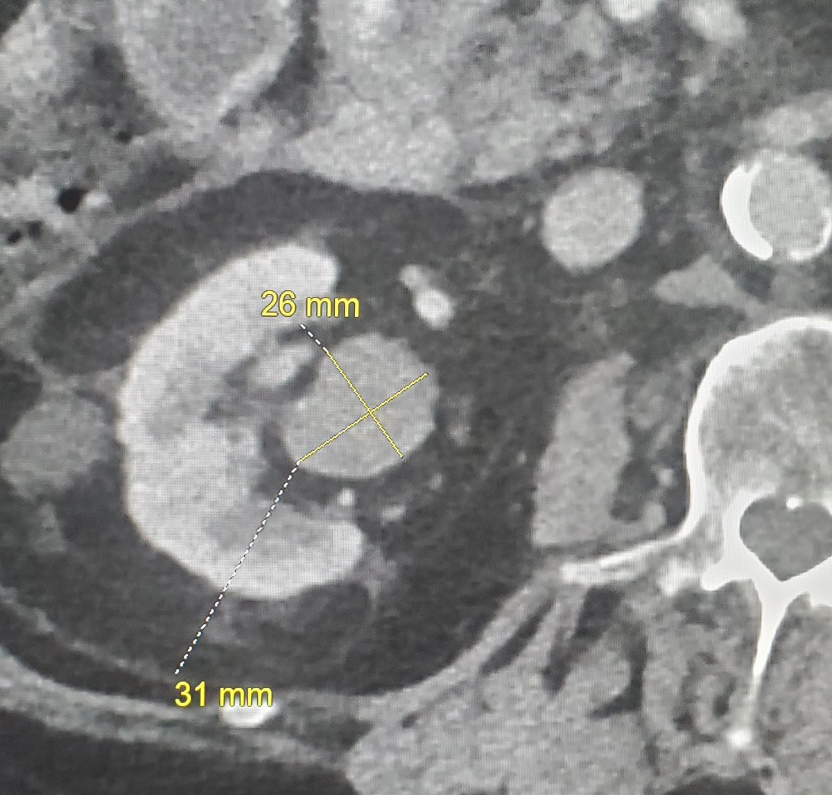 Olga R Brook, MD, FSAR, FSIR, FSABI, FESGAR tweet media