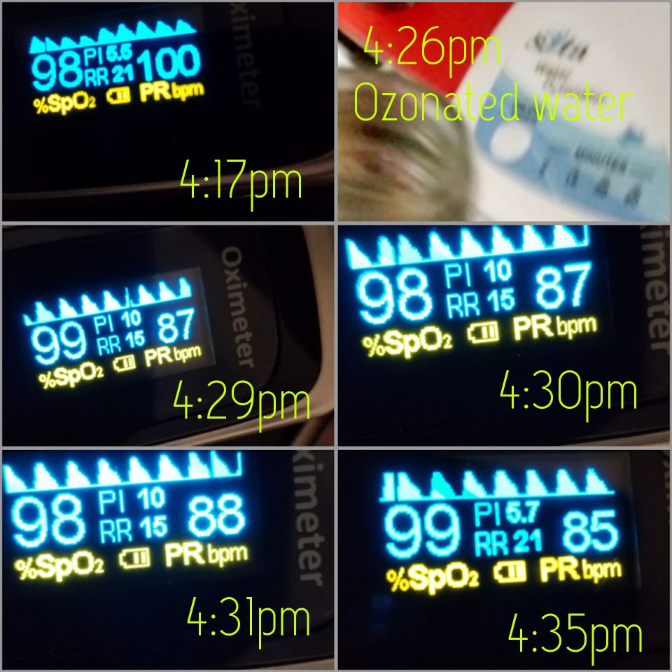 IceAge_Farming's tweet image. Experiment on effect of ozone on myself with a Sota ozonator.  Purpose is to raise PH.