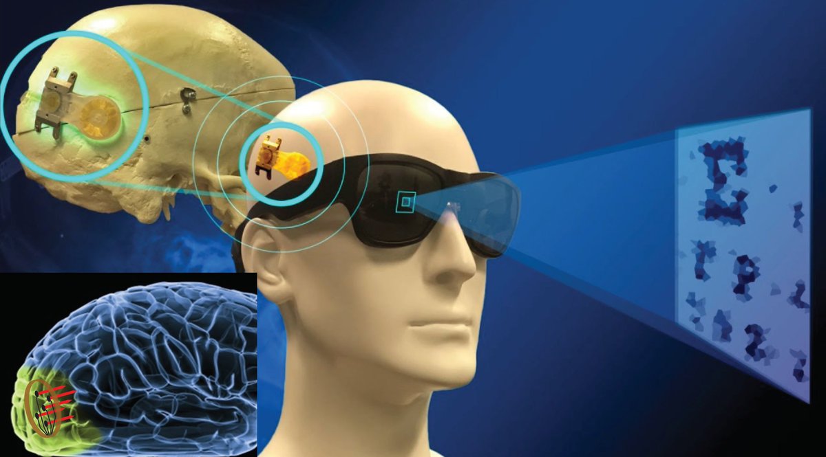 Are you fascinated by the science fiction of Bionic Vision? Would you like to help the blinds to restore their vision? We are looking for a postdoc, working with us to develop a future-generation bionic device implanted in the visual cortex. A job ad will be published very soon!