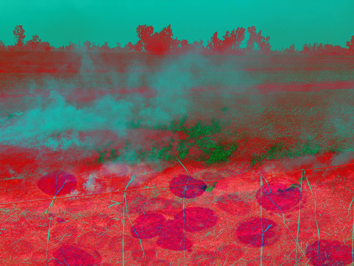 Sukhwinder’s practice is inspired by his own personal experience of living with bone cancer as a child. His work includes a selection of X-ray scans and MRI reports from this time. See his Work Tomorrow 22May <a href="/TheLightbox/">The Lightbox</a> <a href="/UniCreativeArts/">University for the Creative Arts</a> @SukhwinderSDhot